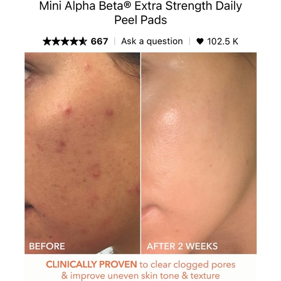 🆕 Dr.Dennis Gross Alpha Beta Extra Strength Daily Peel Pads - Picture 2 of 12